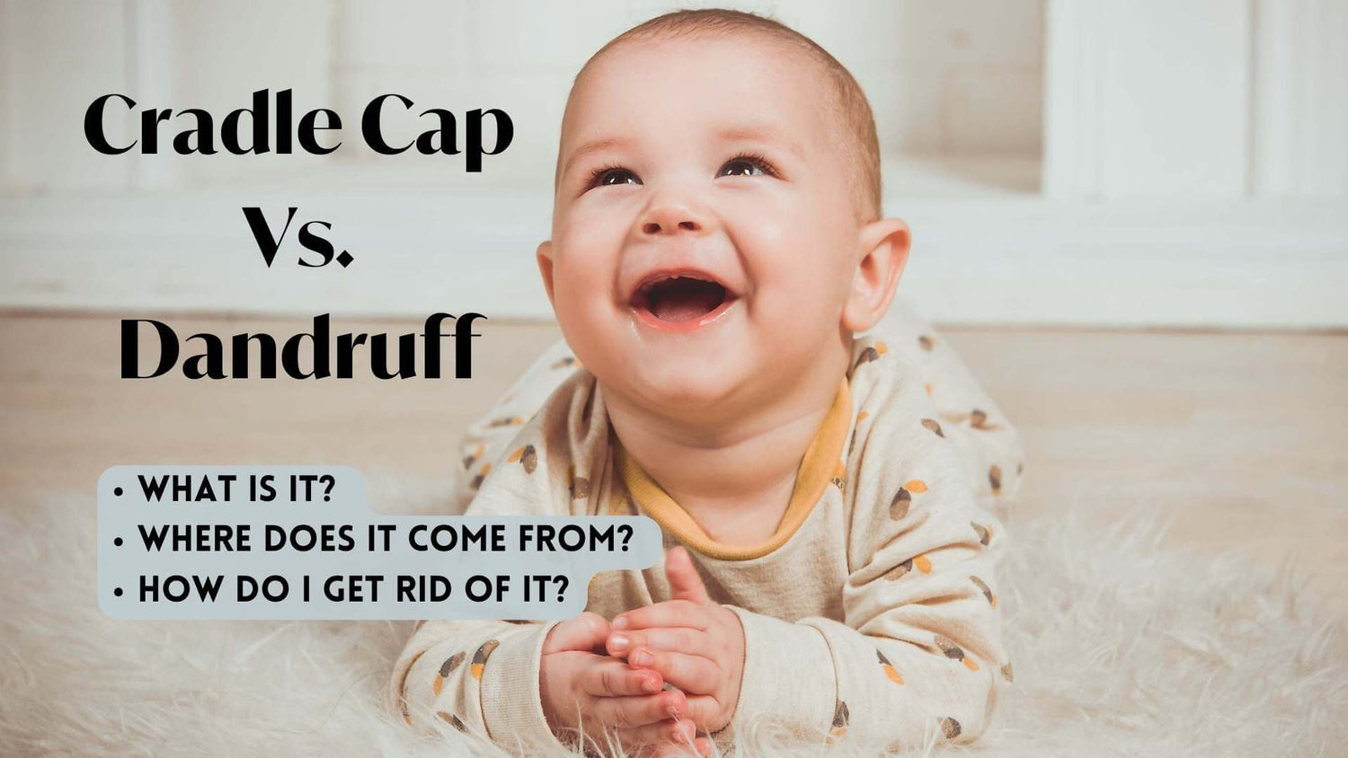 Cradle Cap Vs. Dandruff: Everything you need to know
